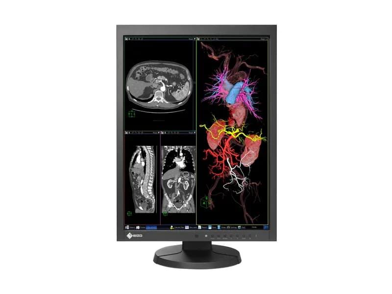 Moniteur Médical EIZO RadiForce MX215 — 24" Color LCD — Made in Japan